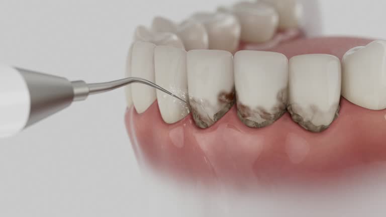 Trusted Tooth Extraction service in Sweetwater, TX - Dentist Open Now